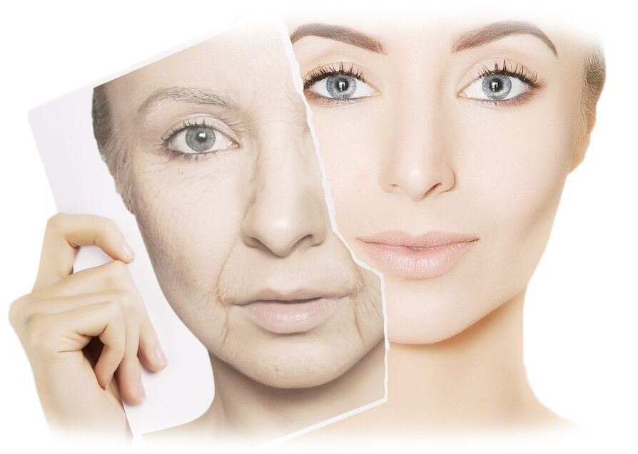 Hoe werkt intenskin-crème voor de regeneratie van de gezichtshuid 